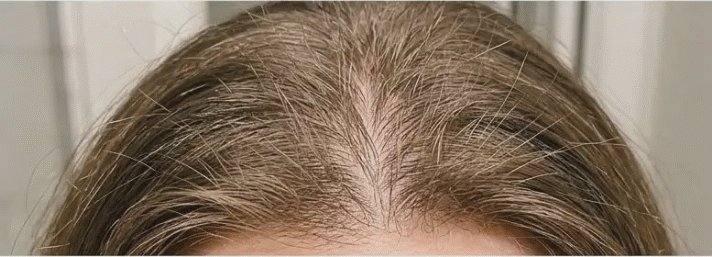 Weeks 6 to 8 of using HaloGrow
