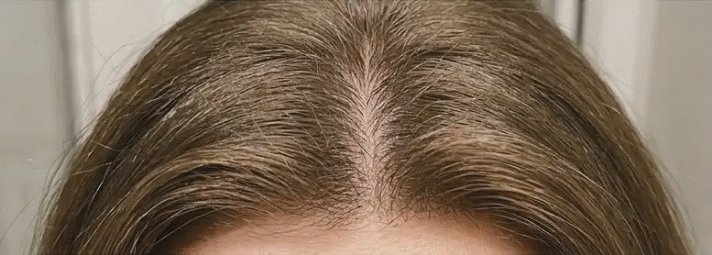 Month 3 and beyond using HaloGrow